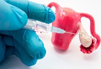 Фотографія Категорії Стимулятори овуляції