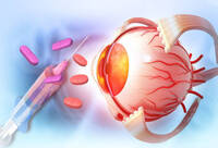 Фотографія Категорії Ліки для очей - Протиглаукомні та міотичні