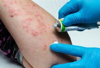 Фотографія Категорії Ліки від грибкових захворювань шкіри