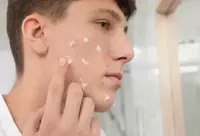 Фотографія Категорії Ліки від акне