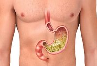 Фотографія Категорії Ліки від печії та гастриту