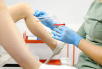 Фотографія Категорії Дзеркало гінекологічне