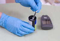 Фотографія Категорії Тести для виявлення кетонів та глюкози