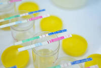 Фотографія Категорії Тести на наркотики, алкоголь, психотропні речовини