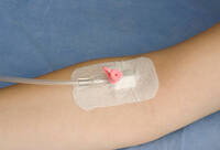 Фотографія Категорії Пластир медичний для фіксації катетера