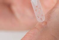 Фотографія Категорії Засоби для видалення бородавок