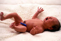 Фотографія Категорії Затискач пуповини