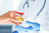 Фотографія Категорії Контейнер для сечі