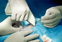 Фотографія Категорії Степлер для шкіри