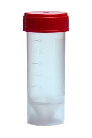 Ємкість для калу Тета, стер. 30мл